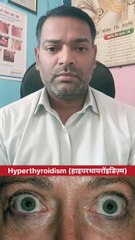 Hyperthyroidism (हाइपरथायरॉइडिज़्म)