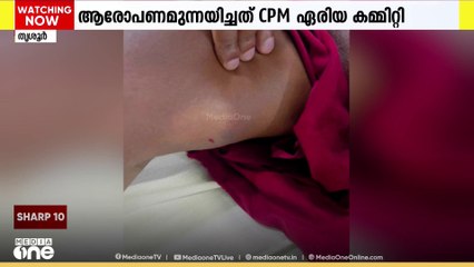 CPM ബ്രാഞ്ച് സെക്രട്ടറി ഉൾപ്പെടെ ആറുപേരെ പൊലീസ് മർദിച്ചു; കുന്നംകുളത്ത് വീണ്ടും ആരോപണം