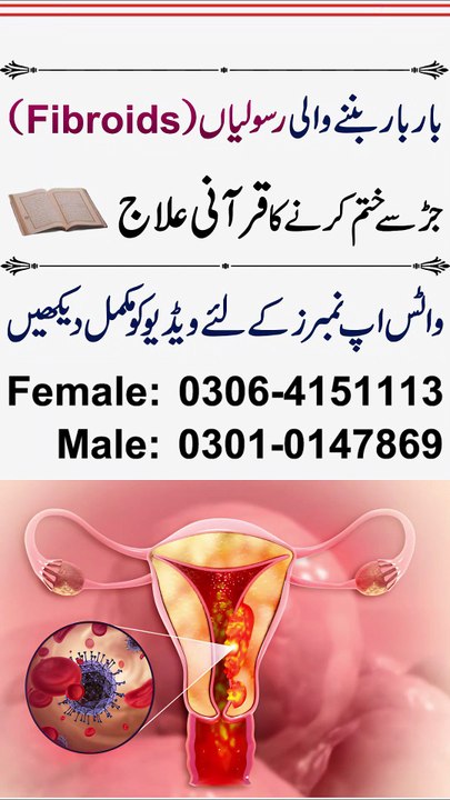 Fibroids Rasoli Banne Ka Amal Rokne Ka Taweez | Best Fibroids Treatment In Quran | Fibroids Ka Ilaj