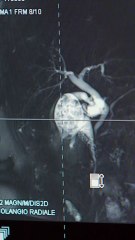 Rocca - Oggi vi portiamo a Colleferro e vi raccontiamo il reparto di Ortopedia e Traumatologia (05.11.25)