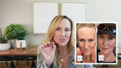 How I Fixed My Eye Wrinkles - Methods That ACTUALLY Work!