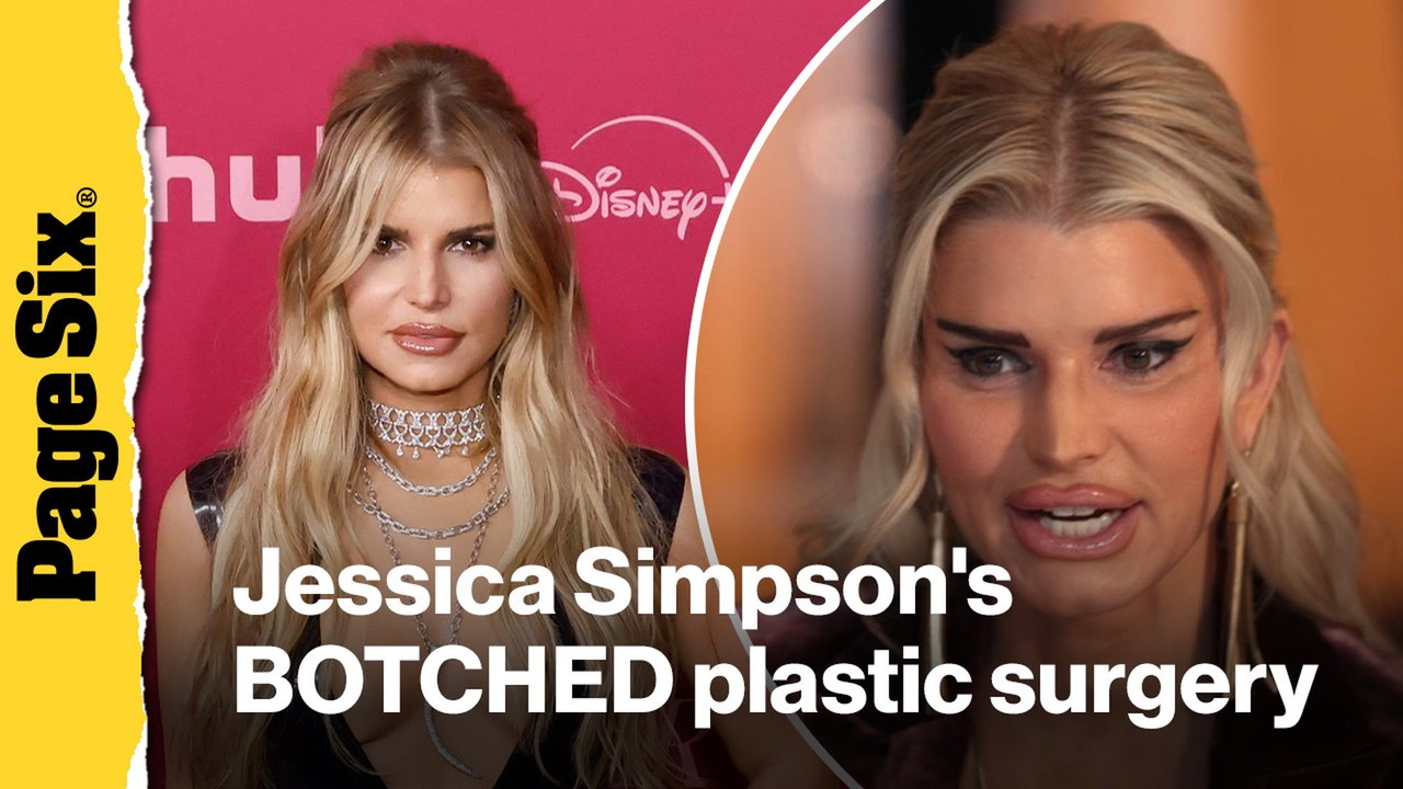 See Jessica Simpson's jaw-dropping BOTCHED plastic surgery face for her 'All's Fair' acting role