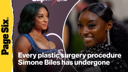 Here is every plastic surgery procedure Simone Biles has had done