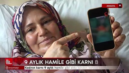 Amasya'da kadının karnı 9 aylık gibi şişti içinden karpuz kadar kitle çıktı