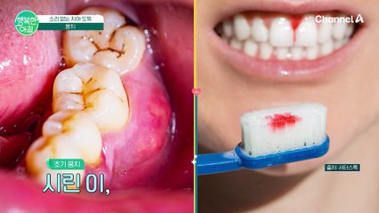 [닥터하우스] 소리없는 치아 도둑 풍치