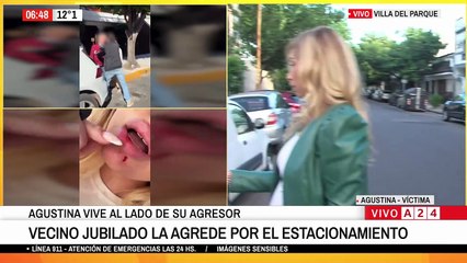 “Me pegó una piña”: el relato de la mujer atacada por su vecino por mal estacionamiento