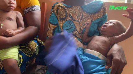 Bénin, hôpital La Croix à Zinvié : Enfants prématurés : privilégier le contact