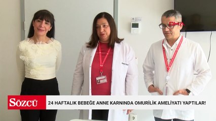 24 haftalık bebeğe anne karnında omurilik ameliyatı yaptılar!