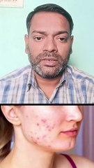 त्वचा की बीमारियों का आयुर्वेदिक इलाज ।