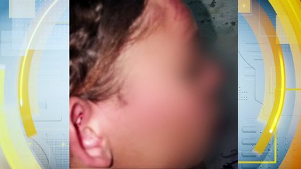 Suspeito Atribui Fúria a Ciúmes e é Preso por Tentativa de Feminicídio: Detalhes e Investigação do Caso Polêmico