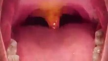 What_Is_The_Purpose_Of_Your_Uvula__🤔(360p)