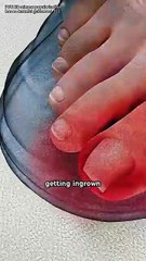 🎉🎉Arms Workout | Best Exercises to Lift Saggy & Flabby Arms 💪✨