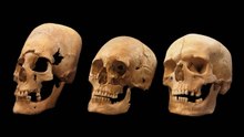 Foreign Eggheads: Pointy-Skulled Women Were Immigrant Brides