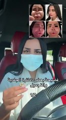 تشوه وجه دانة الشهري بسبب حقنة نضارة