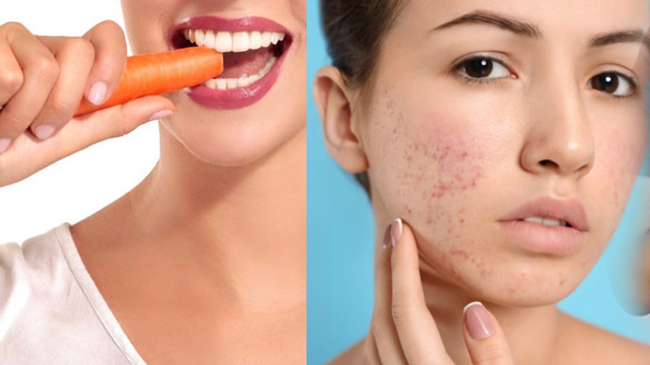 खाली पेट कच्चा गाजर खाने से क्या होता है | Khali Pet Kacha Gajar Khane Ke Fayde | Boldsky