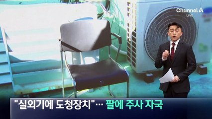 “실외기에 도청장치” 주장…팔에 주사 자국