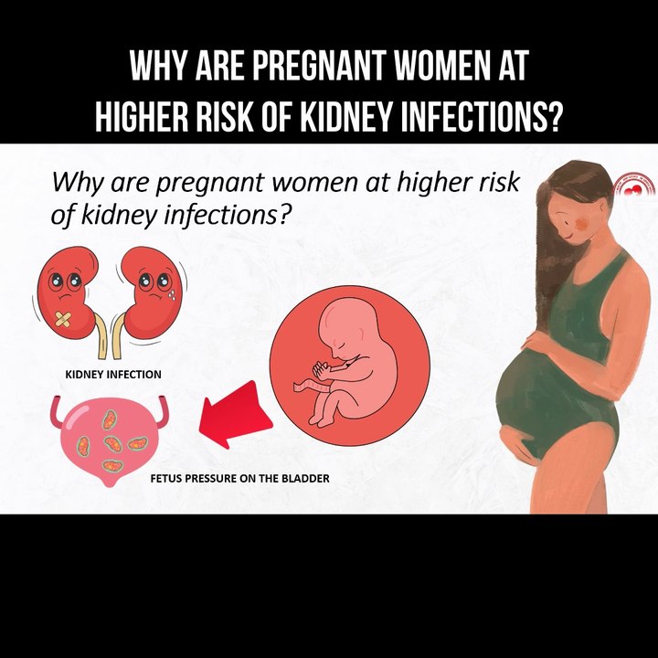 RISK of Kidney Infections in PREGNANCY is NO JOKE