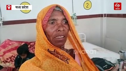 बंद कमरे में अचानक भड़की आग, 3 मासूम झुलसे, सीधी जिला अस्पताल रेफर