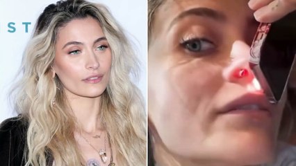 Paris Jackson mostra il setto nasale perforato: «La cocaina mi ha rovinato la vita»