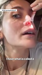 Paris Jackson reveals perforated septum due to drug use