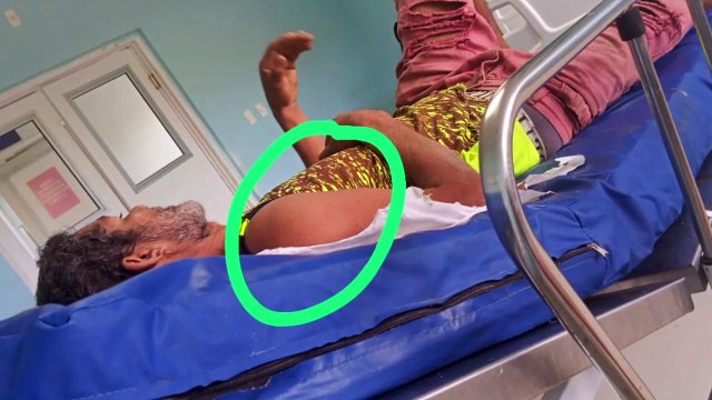 Morte por Negligência Hospitalar em Barreiros: O Caso de Ailton José e a Luta por Justiça em Saúde