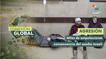 Conexión Global 12-11: Más de seis mil amputaciones en la Franja de Gaza
