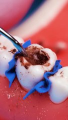 How a dental surgery actually looks #fblifestyle