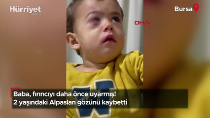 Baba, fırıncıyı daha önce uyarmış! 2 yaşındaki Alpaslan gözünü kaybetti