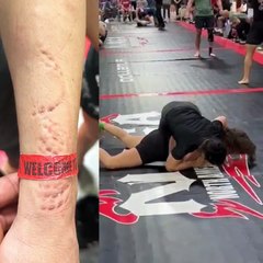 Luchadora de jiu-jitsu revela brutal mordida de su oponente en pleno combate (VIDEO)