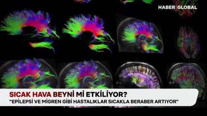 Sıcak hava beyni mi etkiliyor? "Nörolojik hastalıkları tetikliyor"