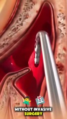 Chronic Sinus Infection Explained | Causes, Symptoms, Treatment & Relief Tips