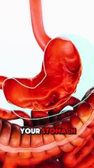 Endoscopic Sleeve Gastroplasty Explained | Weight Loss Procedure, Benefits & Recovery