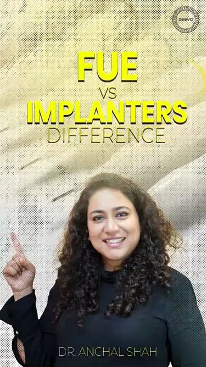 FUE vs Implanter Technique | What’s the Difference?