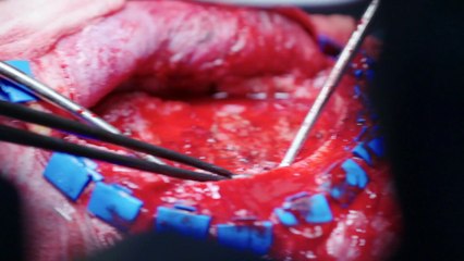 trauma room one s02e05 cbfm