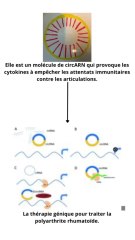 Une thérapie génique pour traiter la polyarthrite rhumatoïde