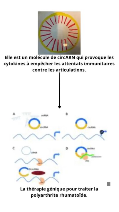 Une thérapie génique pour traiter la polyarthrite rhumatoïde