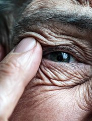 Old lady is pinching her eyelid with wrinkle