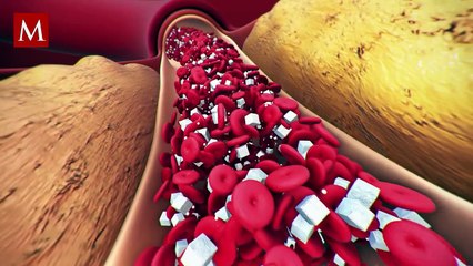 ¿Cuánto cuesta vivir con diabetes en México? Esto dice la Profeco