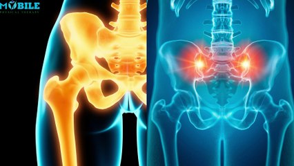 Best Physical Therapy Exercises for Sacroiliac Joint Pain