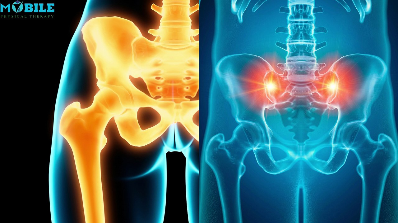 Best Physical Therapy Exercises for Sacroiliac Joint Pain