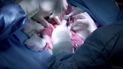 مرحبا بالحياة الحلقة 17 (Arabic Dubbed)