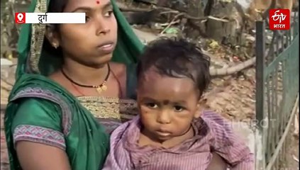 दुर्ग के जंजगिरी में आवारा कुत्ते का आतंक, 2 साल के मासूम को बुरी तरह नोचा, चेहरे के पास 4-5 टांके लगे