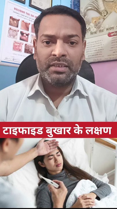 टाइफाइड बुखार के लक्षण ।