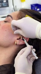 Precision and Style: The Forward Helix #forwardhelix #helixpiercing #daithpiercing #nosepiercing