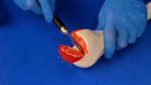 Knee Replacement in Action: See How It’s Done Safely