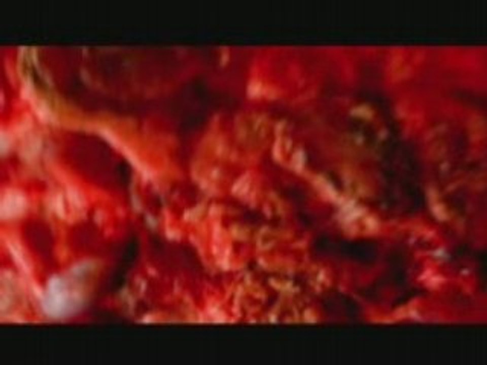 Eths - Bulimiarexia
