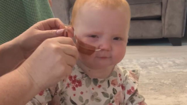 Baby girl overcomes Pierre Robin Sequence and finally gets NG feeding tube removed