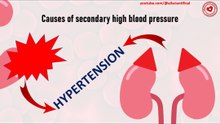 Causes of secondary high blood pressure