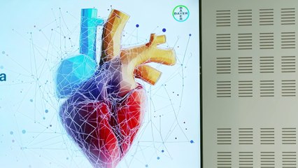 Expertos analizan los avances y retos en el manejo de la amiloidosis cardiaca por transtiretina