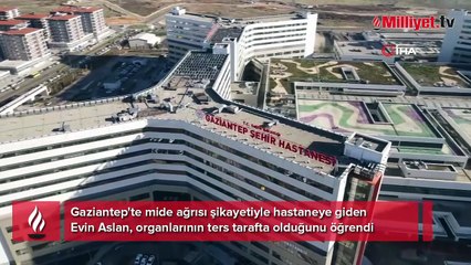 Mide ağrısıyla gitti, hayatının şokunu yaşadı! Organlarının tamamı ters tarafta çıktı